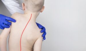 Tüm dünyada yaygın bir sorun olan, çocukların kendi yaşlarındaki başka