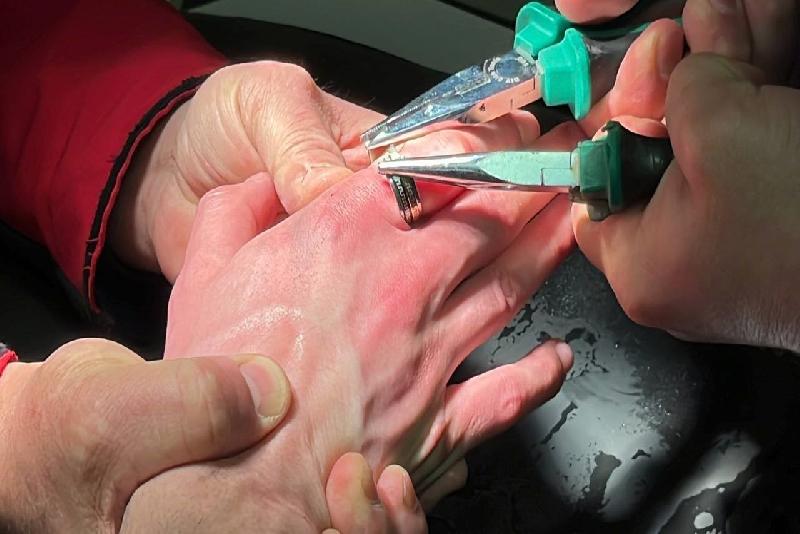 Bolu’da işaret parmağına yüzük sıkışan bir vatandaşın yardıma itfaiye ekipleri